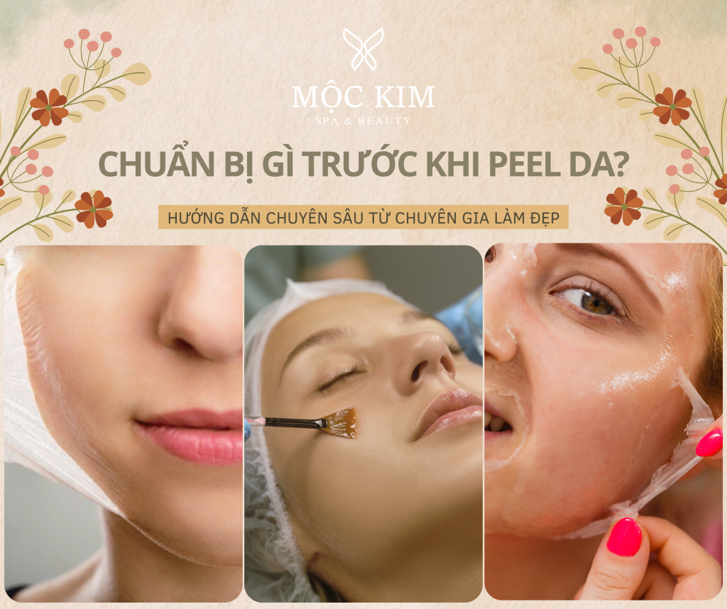 dai dien 19 - Chuẩn bị gì trước khi peel da? Hướng dẫn chuyên sâu từ chuyên gia làm đẹp