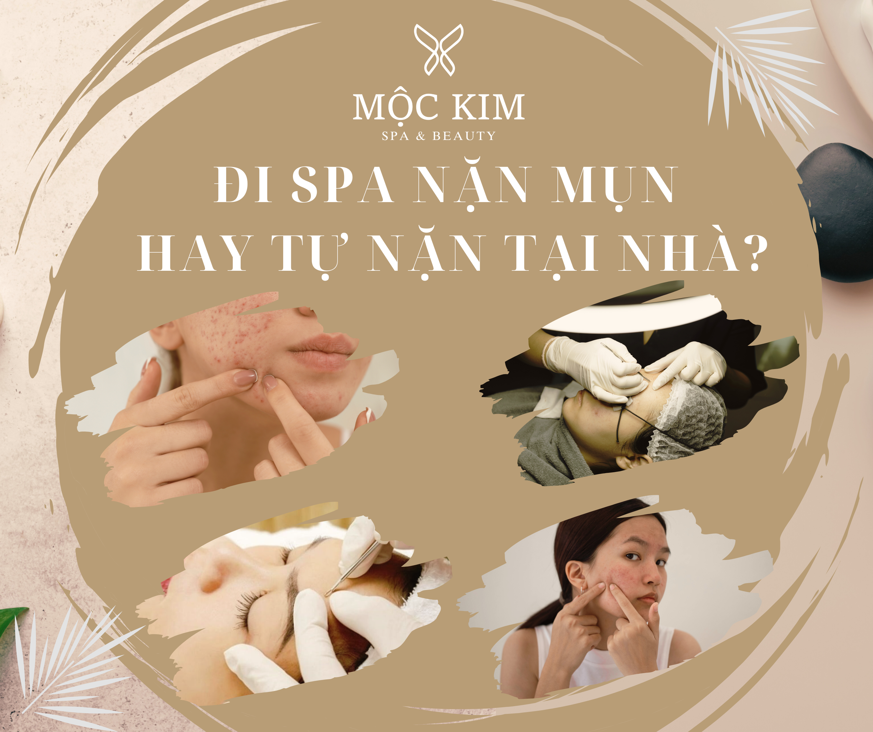 Có Nên Đi Spa Nặn Mụn Không? 7 Lời Khuyên Từ Chuyên Gia Da Liễu Hàng Đầu 29 dai dien 23 - 你应该去水疗中心祛痘吗?顶尖皮肤科医生的 7 个建议
