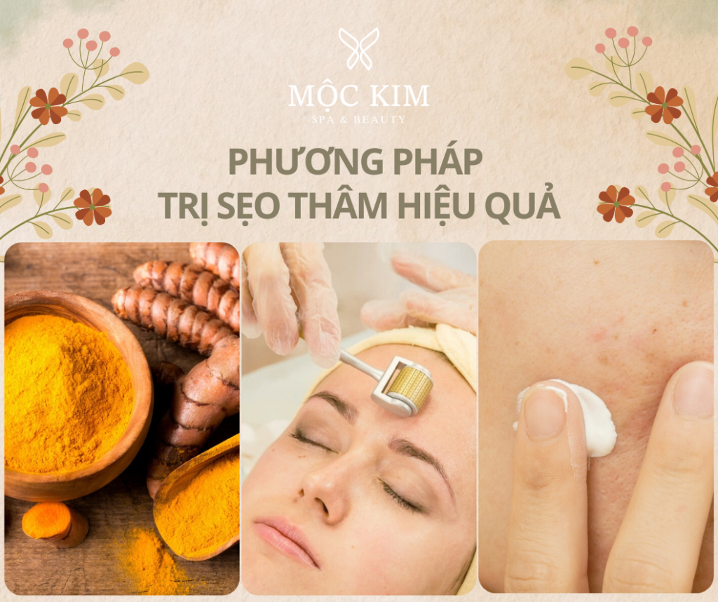 dai dien 37 - Làm Sao Để Trị Sẹo Thâm Ở Mặt? 3 Phương Pháp Hiệu Quả Đã Được Kiểm Chứng