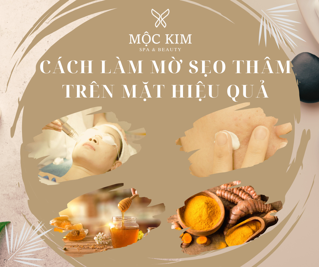 dai dien 44 - 얼굴의 검은 흉터를 자연 흉터부터 의료 흉터까지 희미하게 만드는 7가지 방법 목록