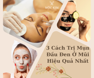 3 cách trị mụn đầu đen ở mũi