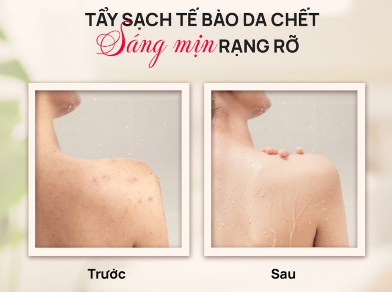 Chọn Sản Phẩm Tắm Tẩy Da Chết Body