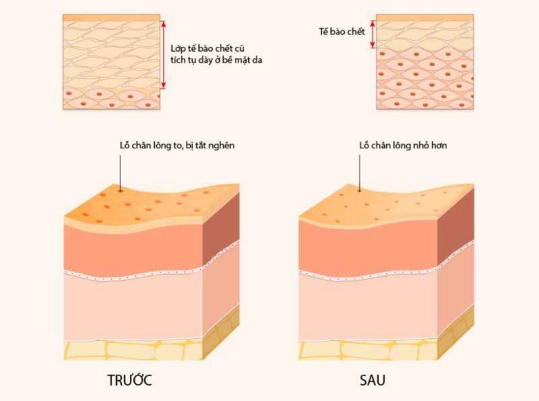 cách tẩy tế bào chết cho da mặt