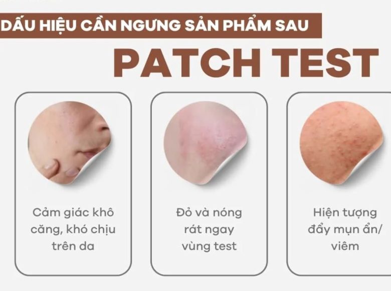 Mặt nạ hoa hồng: công dụng và cách dùng hiệu quả