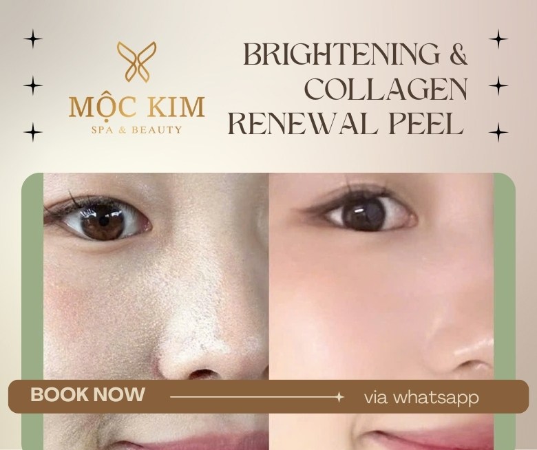 Peel Da Quận 1 TP.HCM – Liệu Trình Peel Sáng Da & Tái Tạo Collagen Tại Mộc Kim Spa 3 Peel sáng da quận hồ chí minh